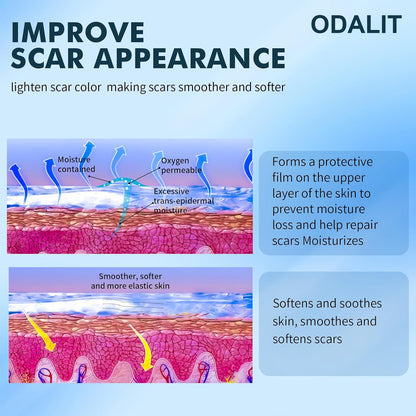 Instantly Smoother Skin with ODALIT – Say Goodbye to Scars Today!